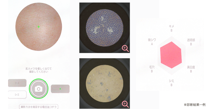 肌カメラ診断結果一例